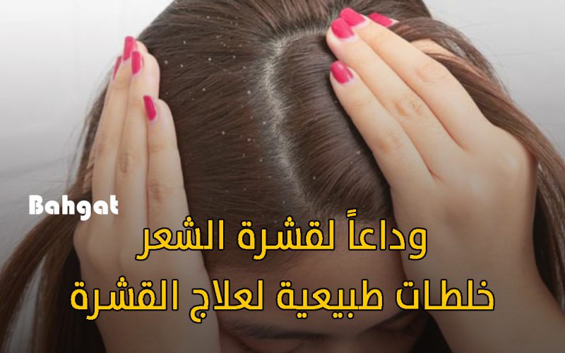 “وصفات سريعة المفعول” تخلصي فوراً من قشرة الشعر باستخدام هذه المكونات الطبيعية