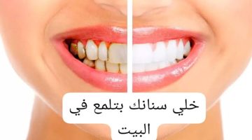 هتبقى بيضا وبتلمع بوصفة سحرية!!.. وصفات إزالة جير الأسنان في المنزل ووفري فلوسك 2024