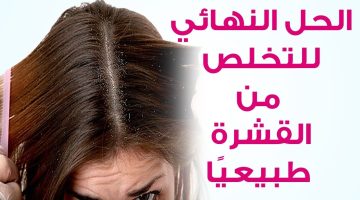 مش هتشتكي منها تاني.. وصفات طبيعية لقشرة الشعر جربها وهتدعيلي